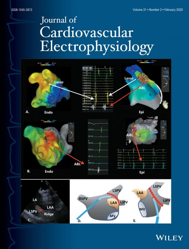 Journal of Cardiovascular Electrophysiology Cover Image